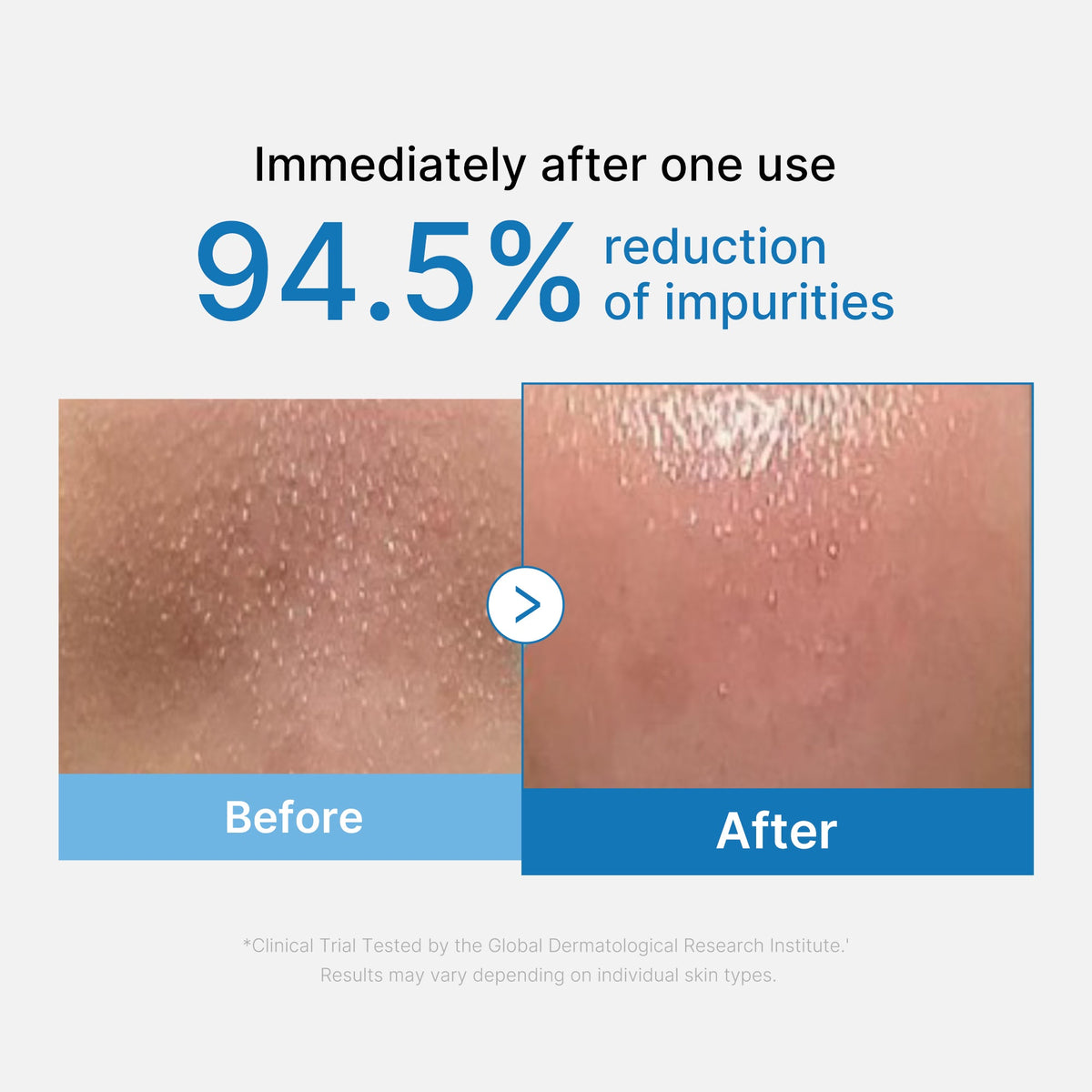 Zero Pore Blackhead Deep Cleansing Oil — 2