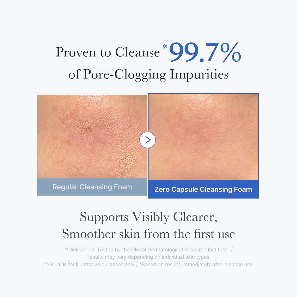 Zero Pore Capsule Cleansing Foam — 3