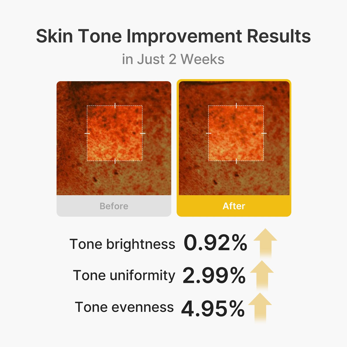 Kojic Acid Turmeric Vita Capsule Cream — 4