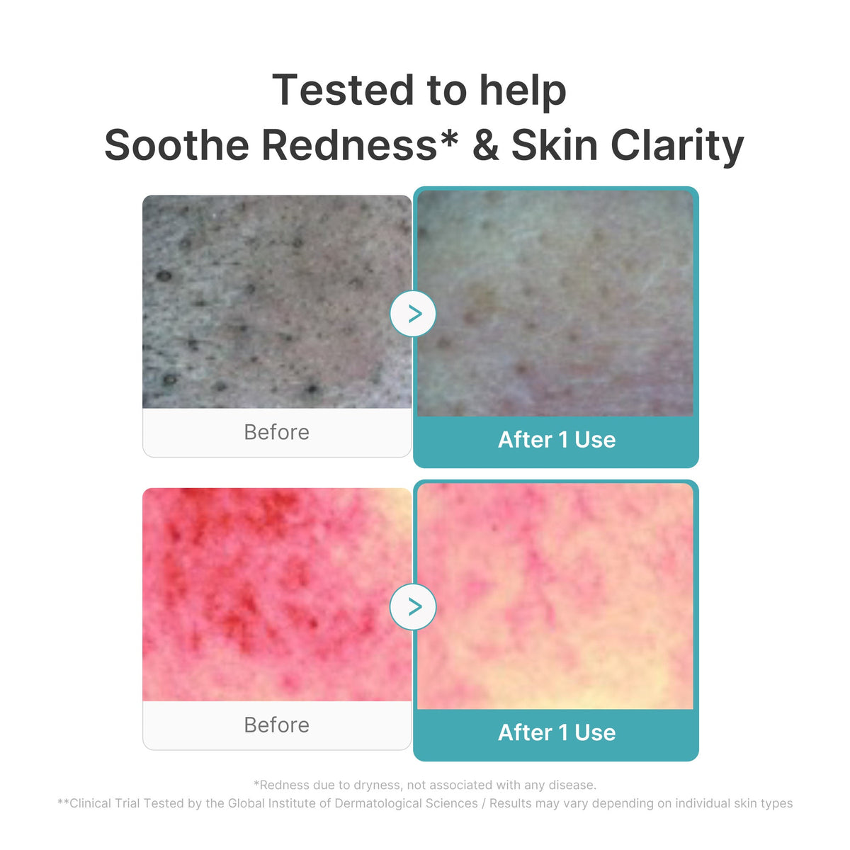 Azelaic Acid Capsule Foam Cleanser — 4