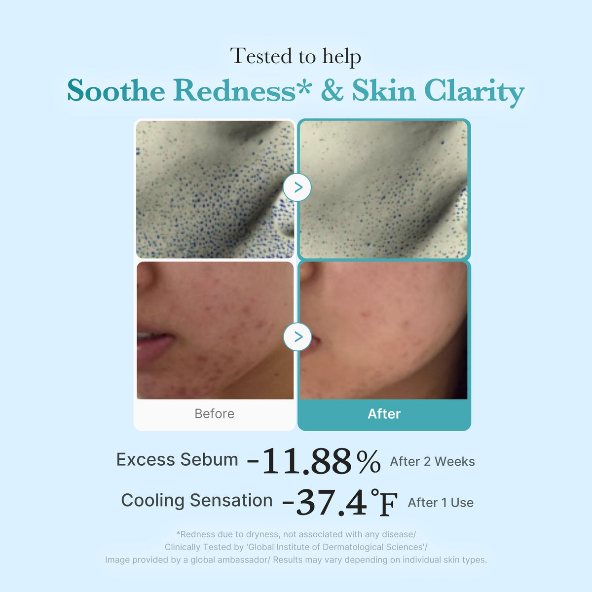 Azelaic Acid Niacinamide Clarifying Toner — 4