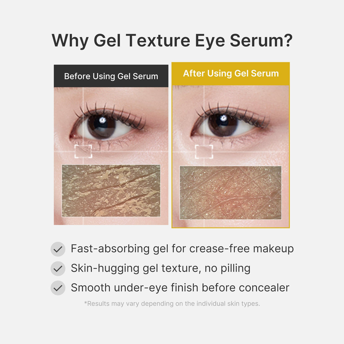 Kojic Acid Turmeric Eye Gel Serum — 6