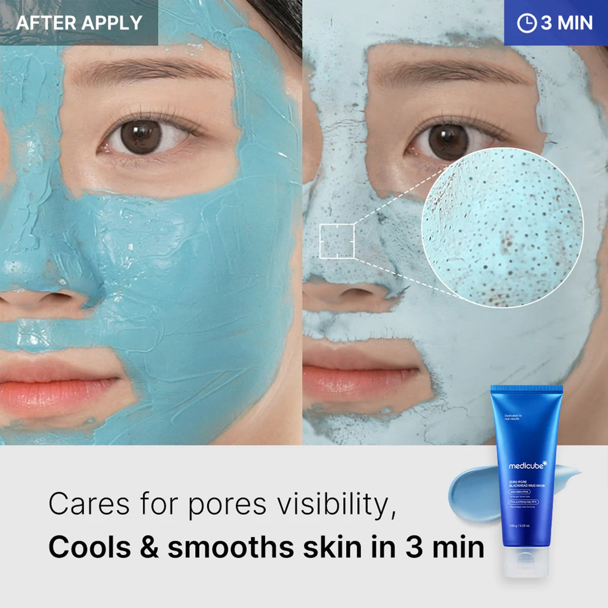 Zero Pore Blackhead Mud Mask — 4