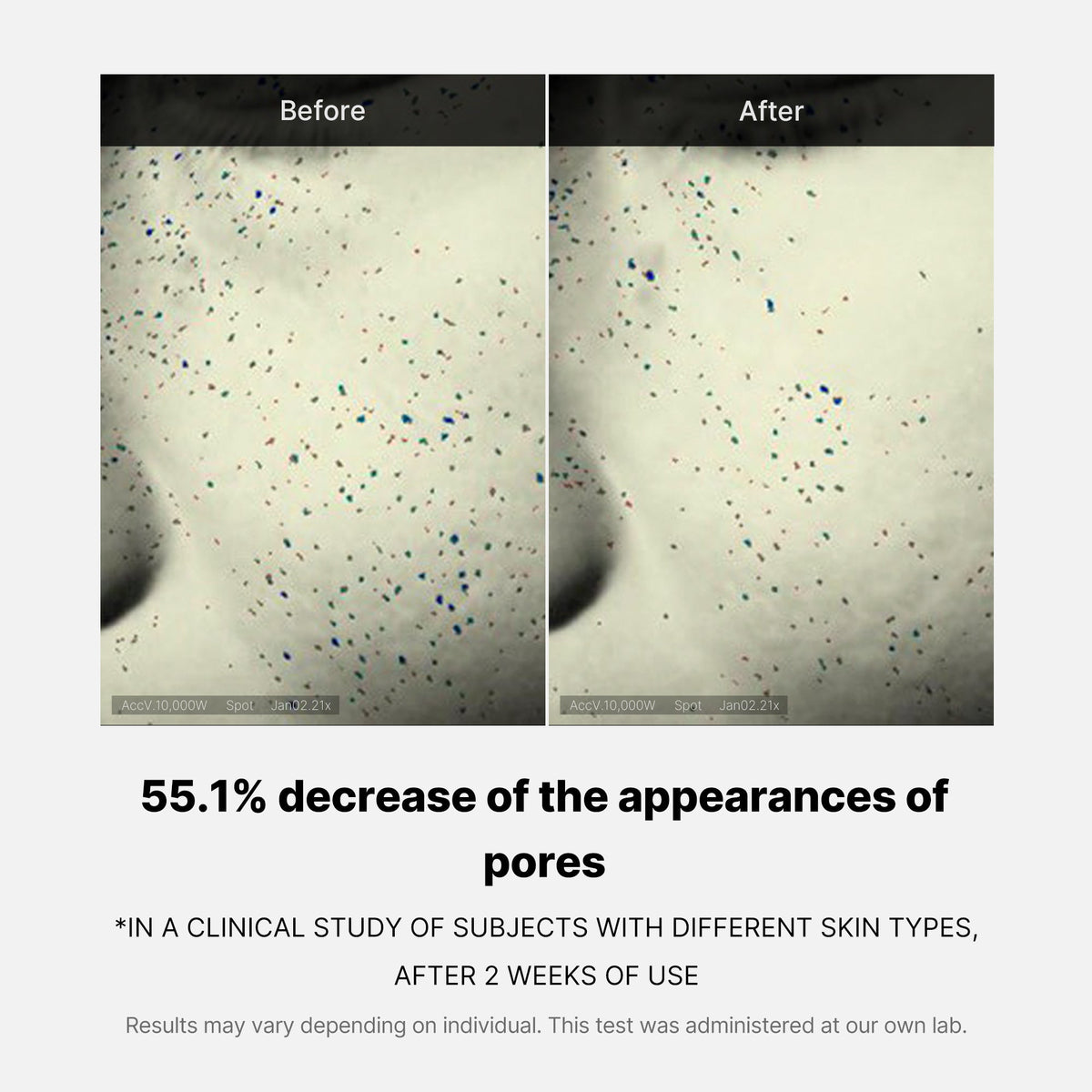 Pore Care Duo — 10