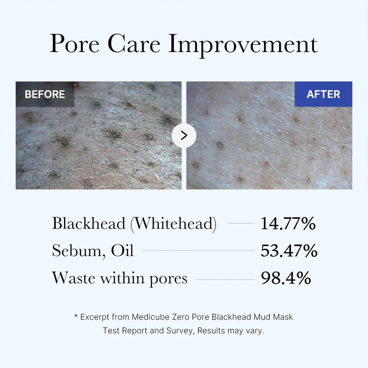 Zero Pore Blackhead Mud Mask — 5