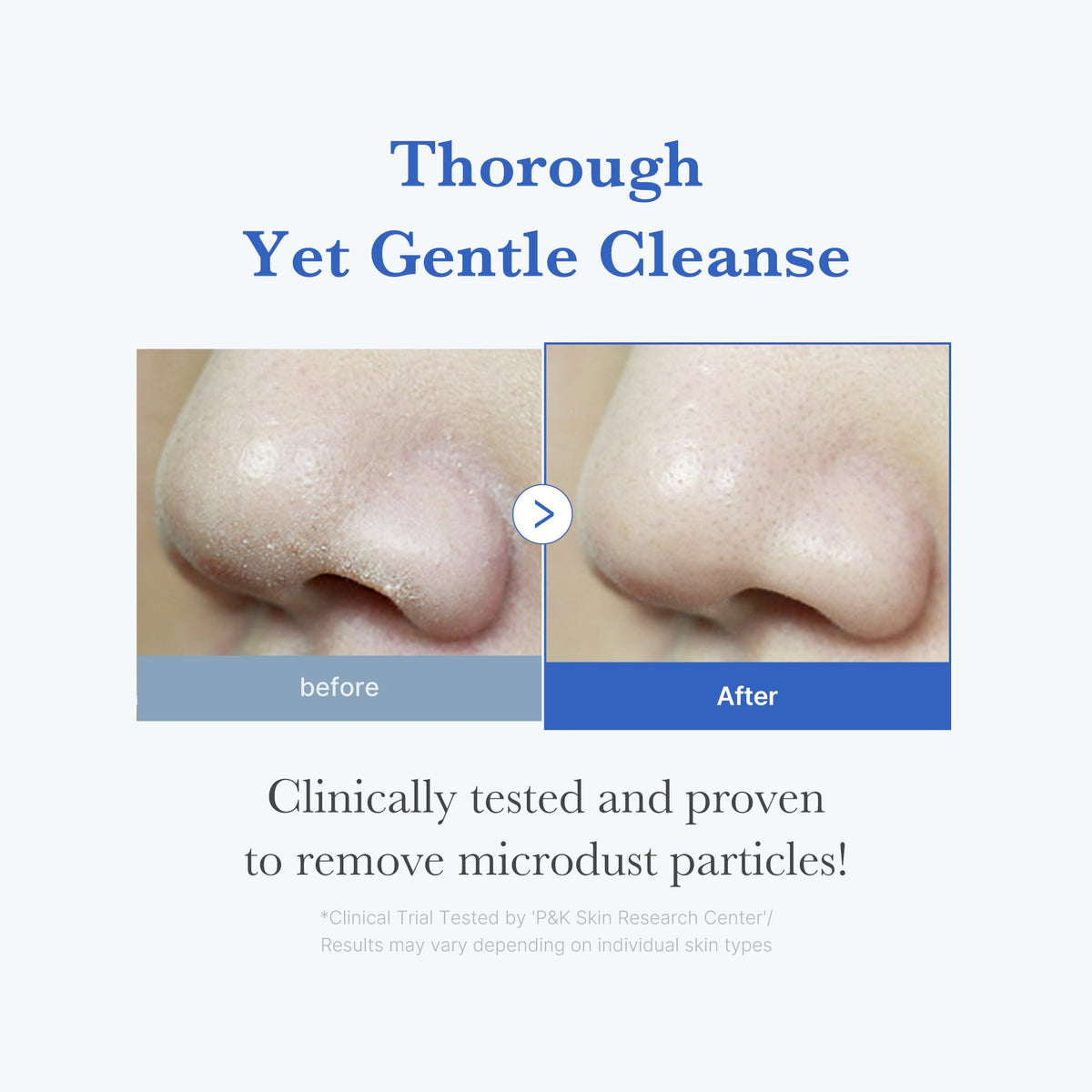 Zero Foam Cleanser — 3