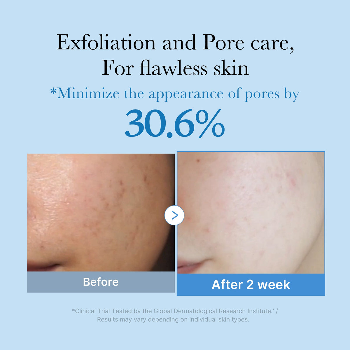 Zero Pore Toner — 2