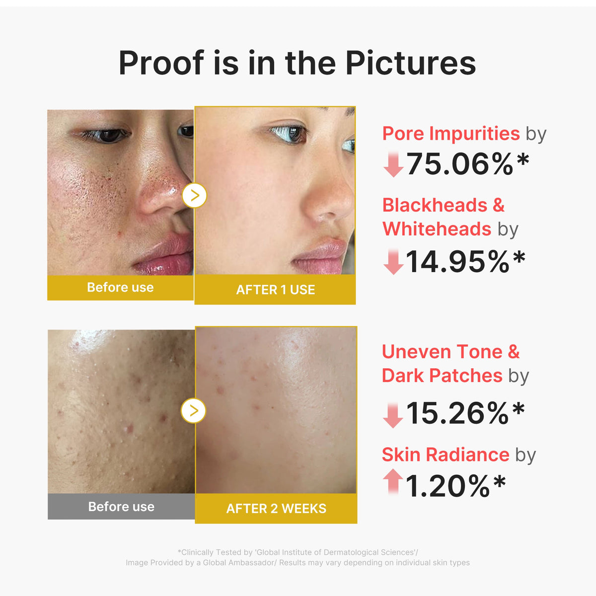 Kojic Acid Turmeric Peel Shot — 3