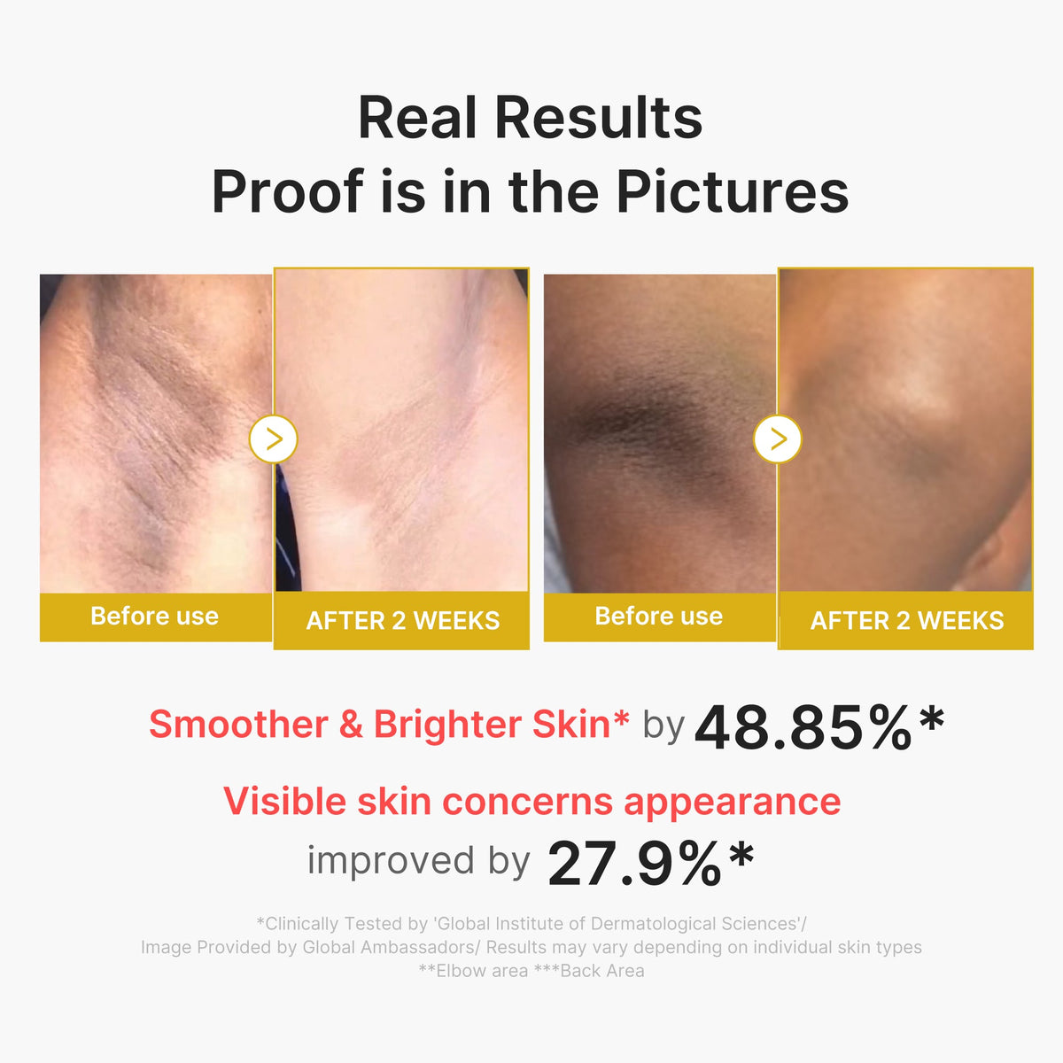 Kojic Acid Turmeric Body Peel Shot — 3