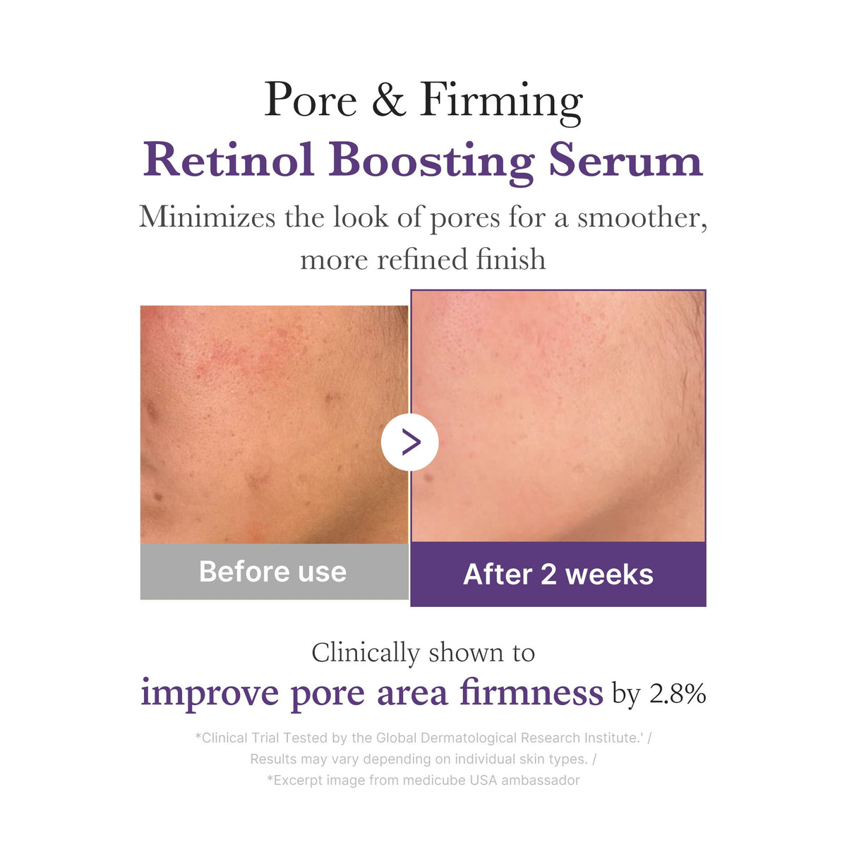 Retinol NMN Boosting Serum — 4
