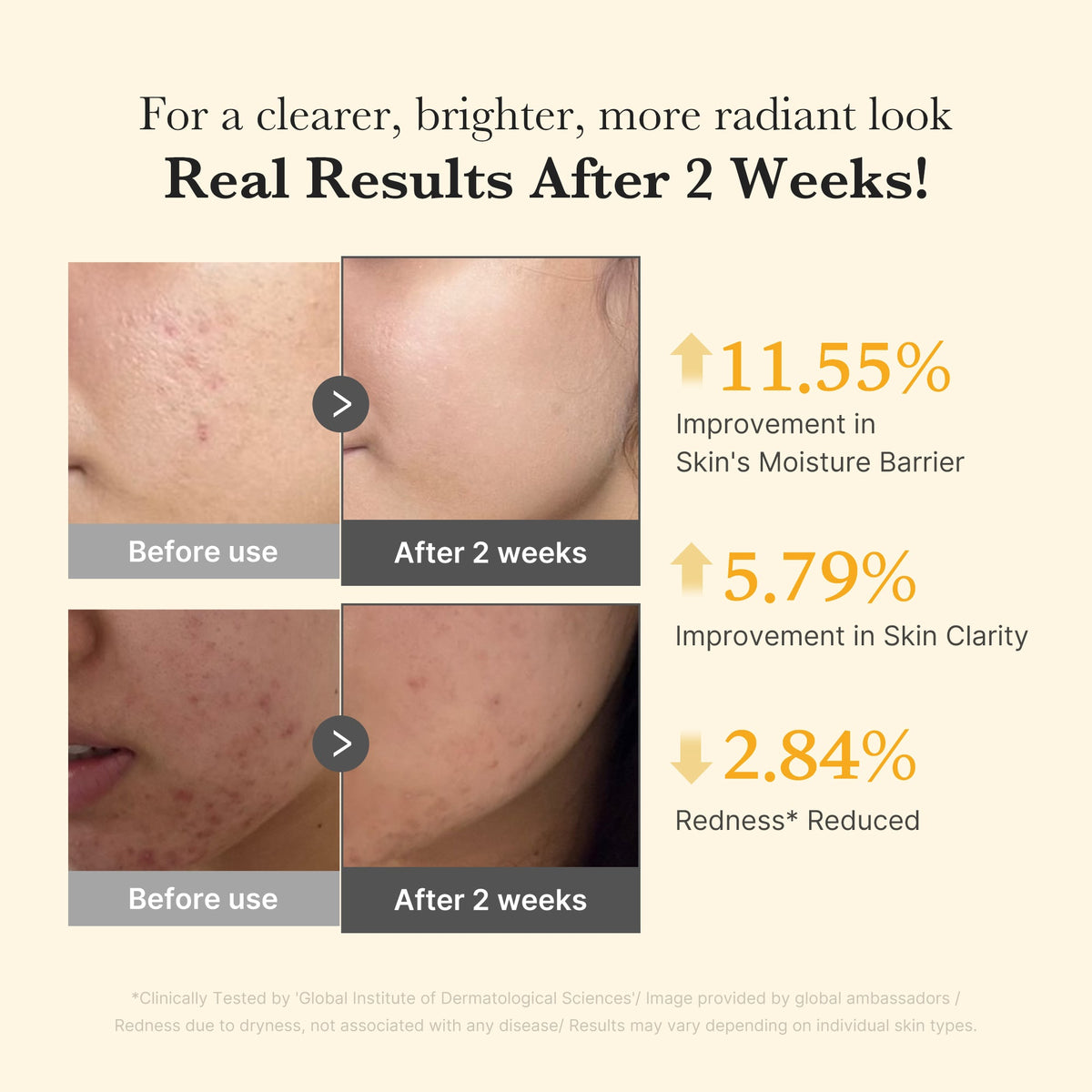 Kojic Acid Turmeric Capsule Serum — 4