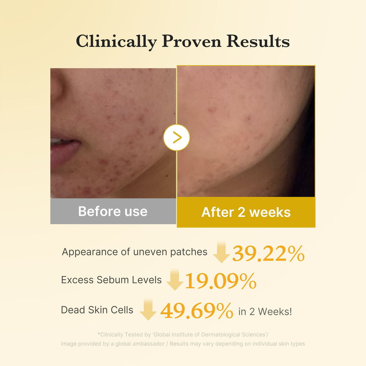 Kojic Acid Turmeric Toner Pad — 4