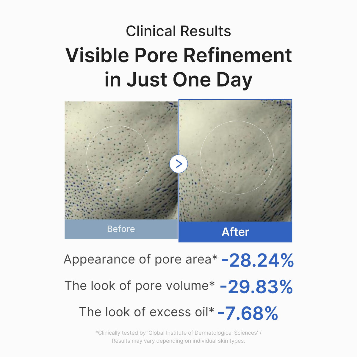 Pore Care Duo — 5