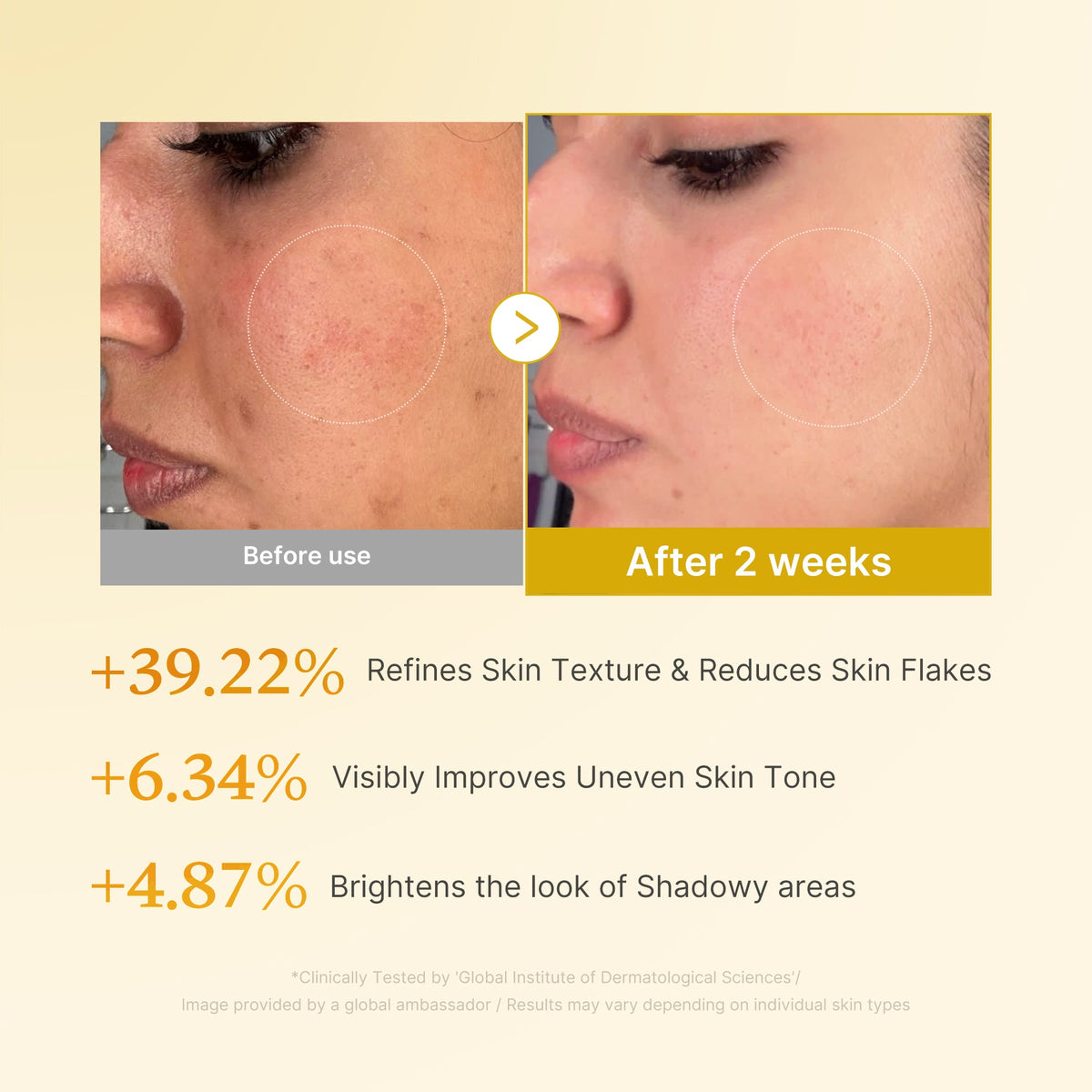 Kojic Acid Turmeric Toner — 4