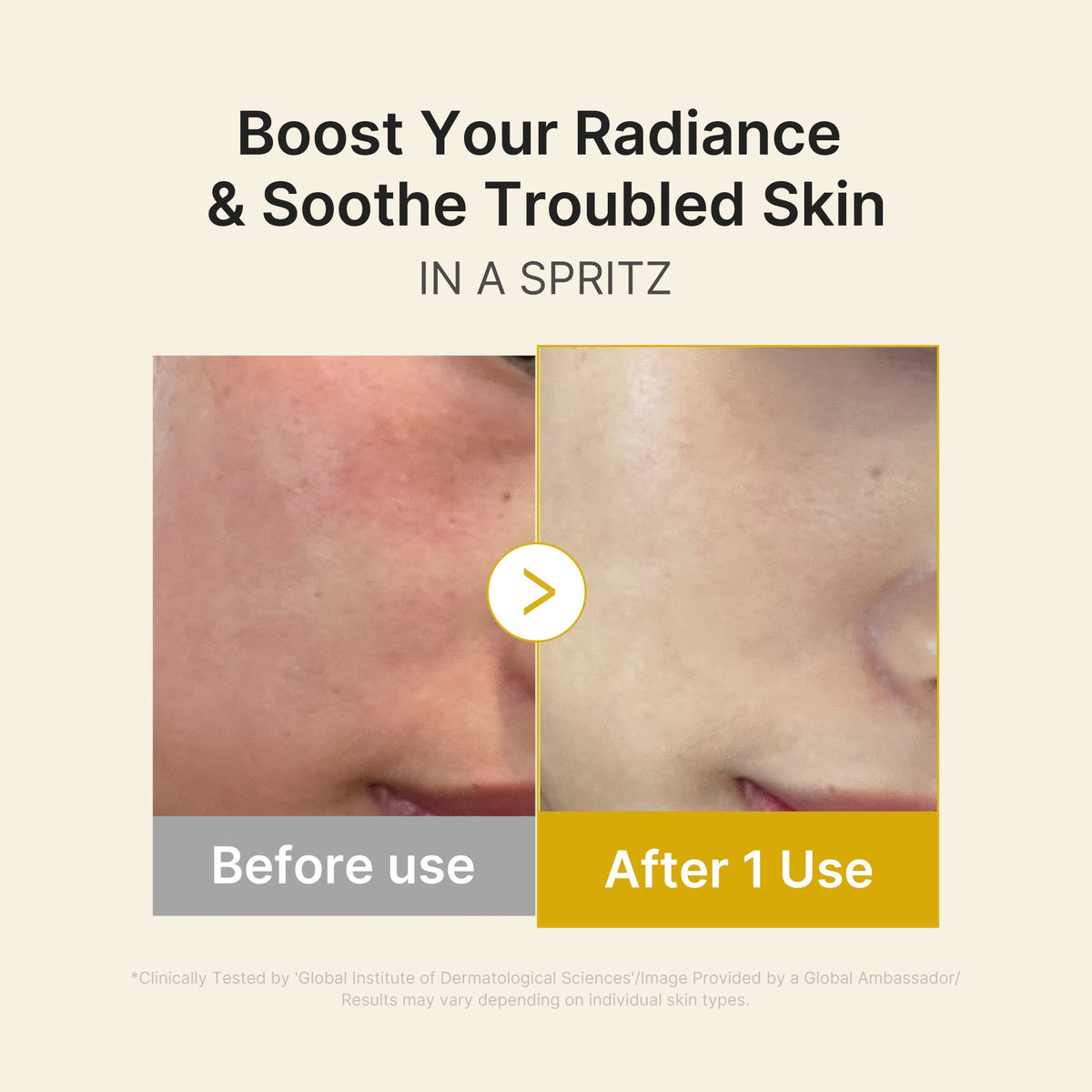 Kojic Acid Turmeric Vitamin Gold Jelly Mist Serum — 4