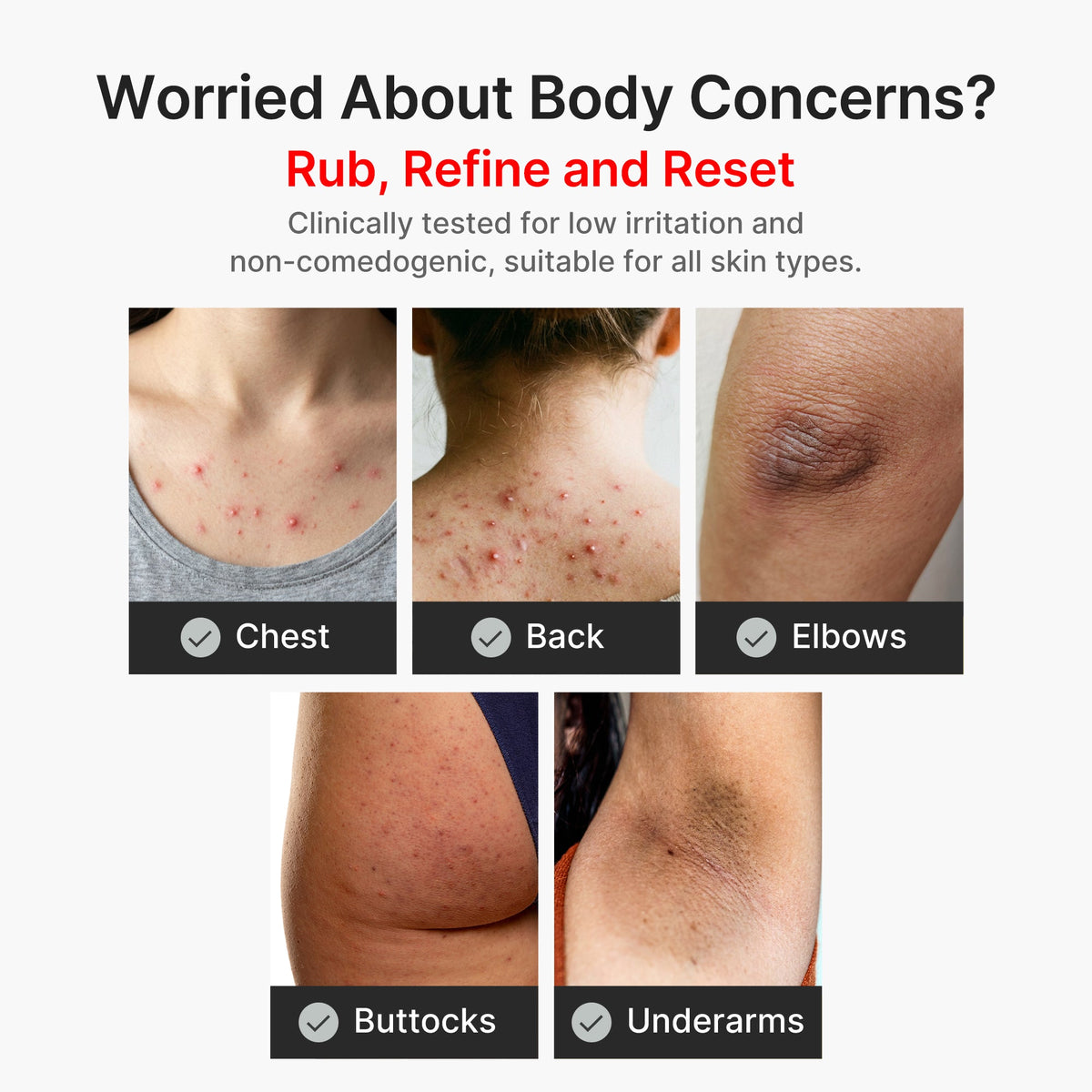 Kojic Acid Turmeric Body Peel Shot — 5