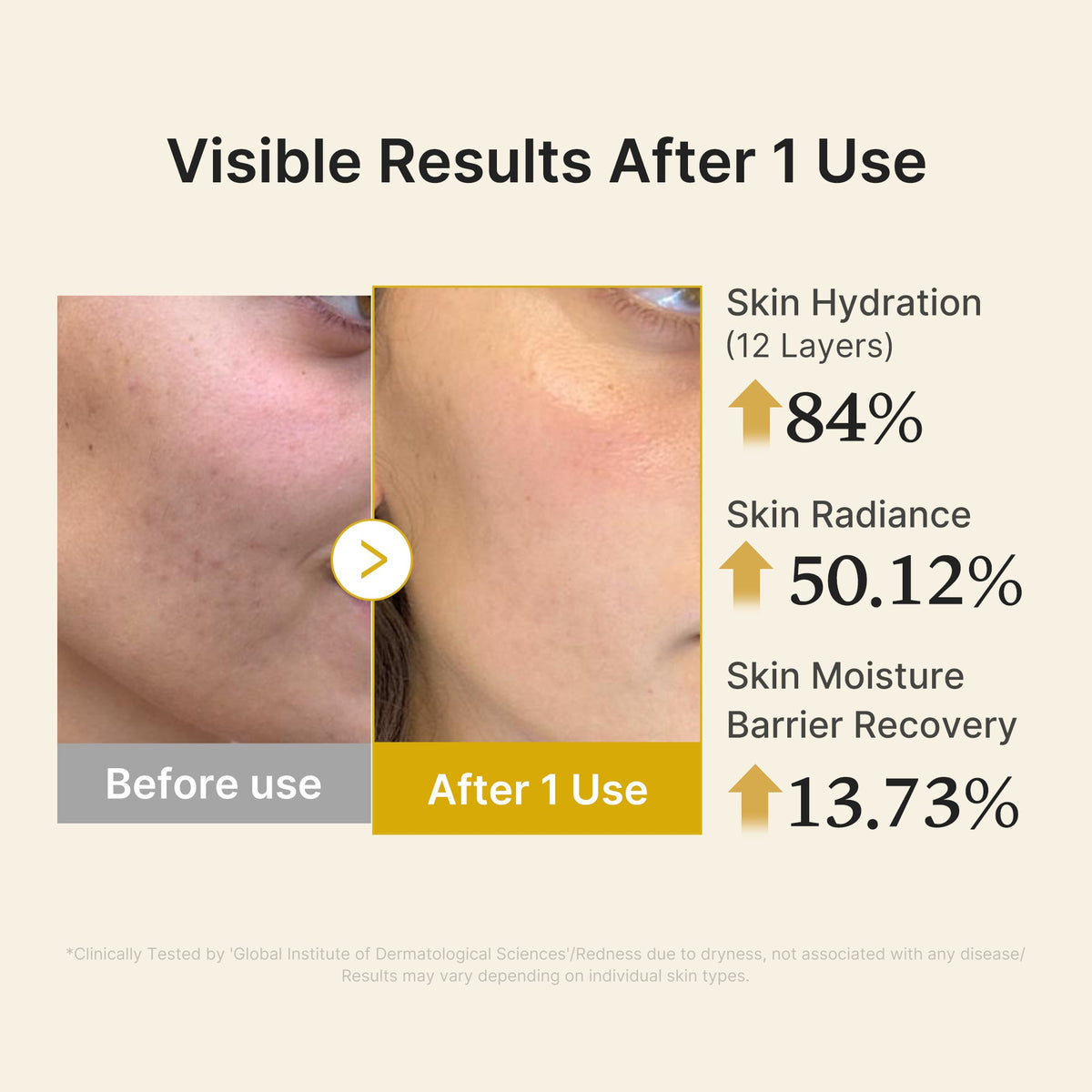 Kojic Acid Turmeric Vitamin Gold Jelly Mist Serum — 5