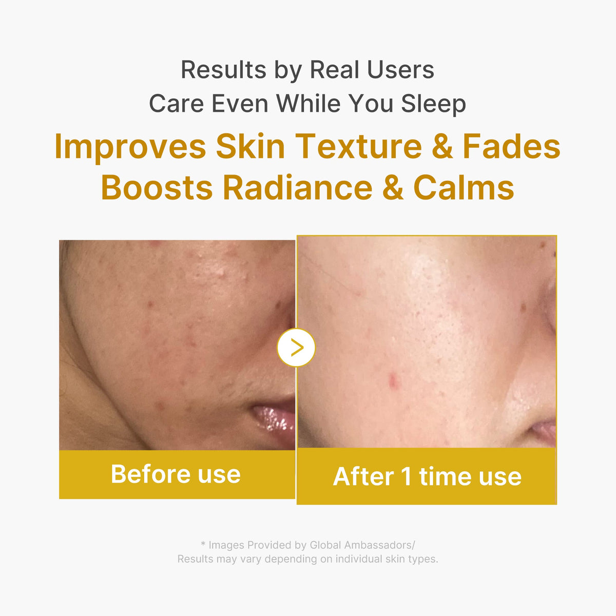 Kojic Acid Turmeric Overnight Wrapping Mask — 6