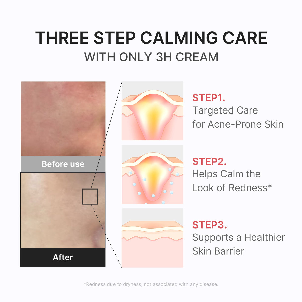 3H Daily Relief Cream — 5