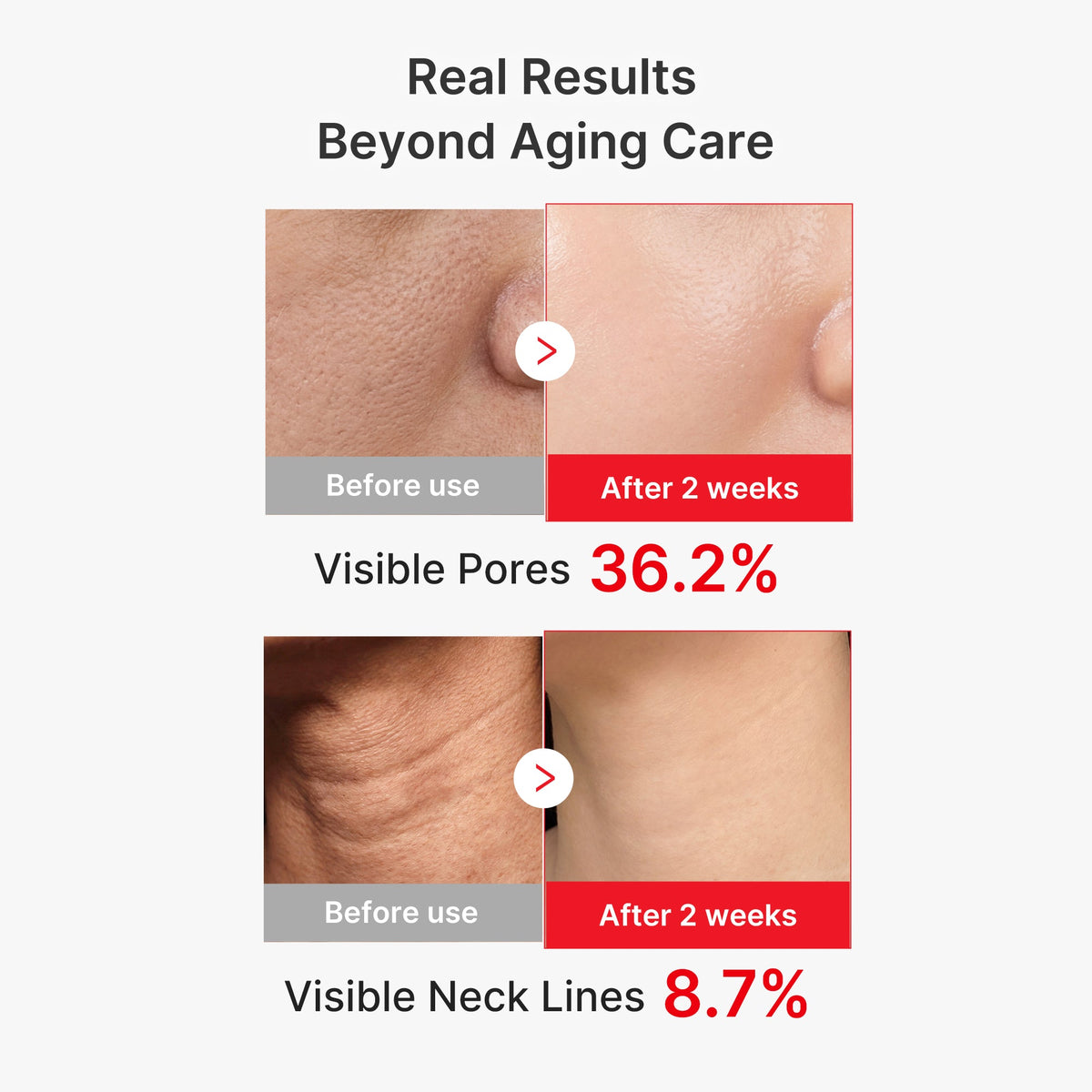 7-Day Anti-Aging & Plump Set — 3