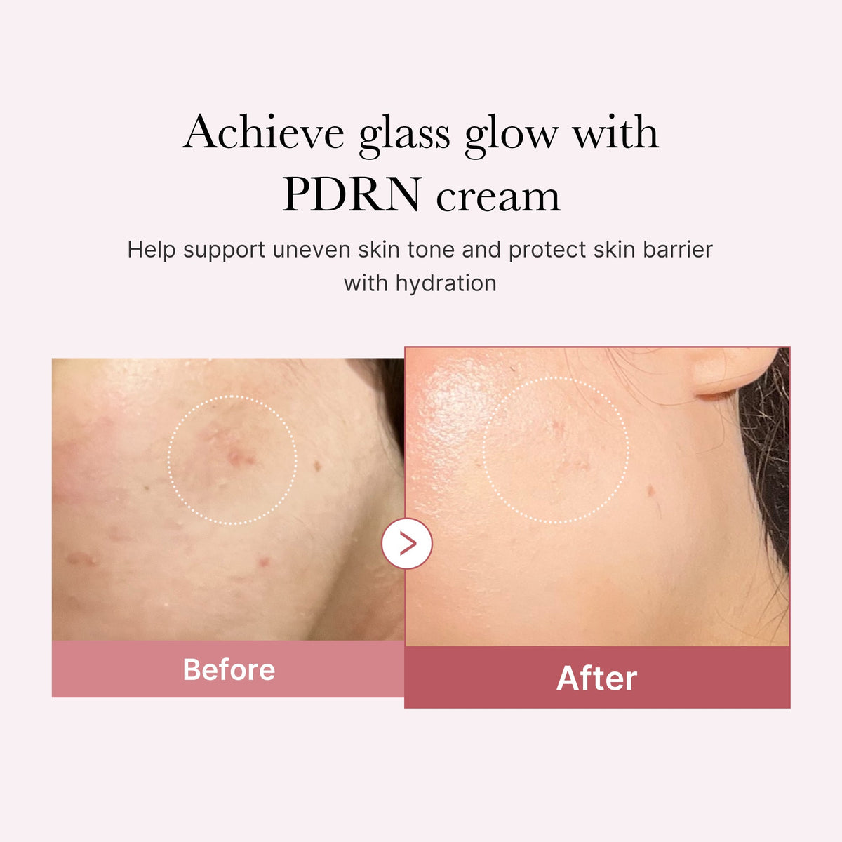 PDRN Pink Peptide Cream — 3