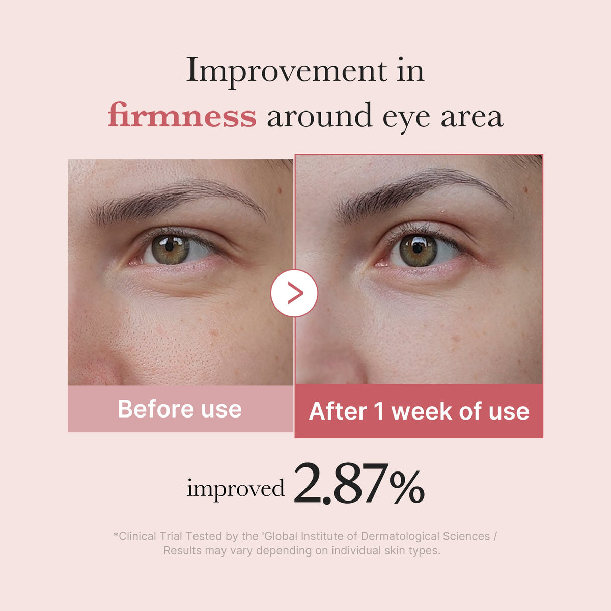 PDRN Pink Peptide Eye Cream — 4