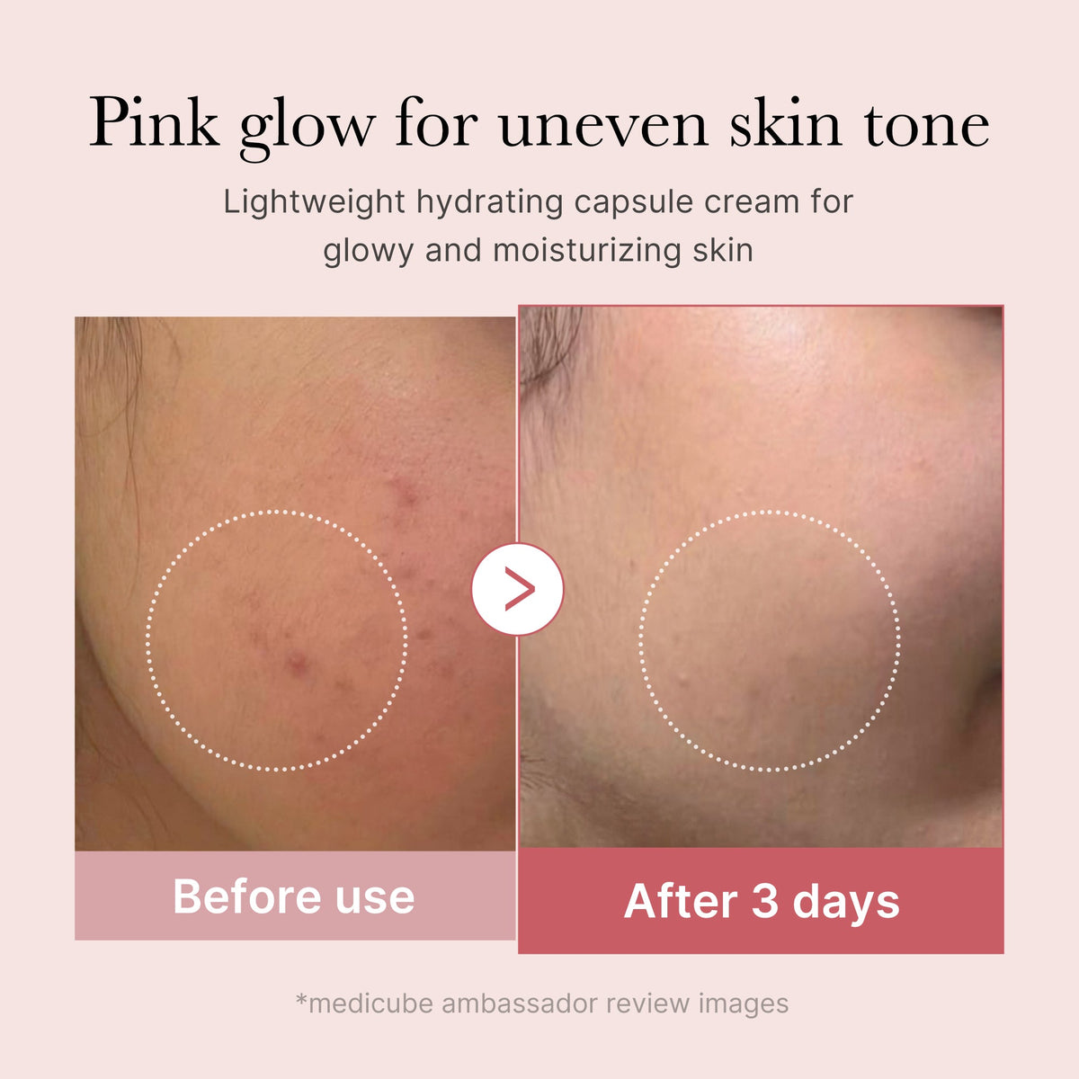 Ultimate PDRN 2X Glow Set — 10