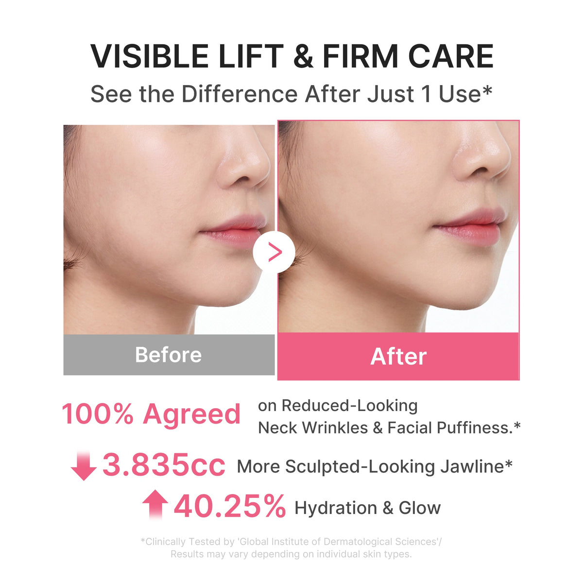 PDRN Collagen Gua Sha Neck Wrinkle Cream — 4