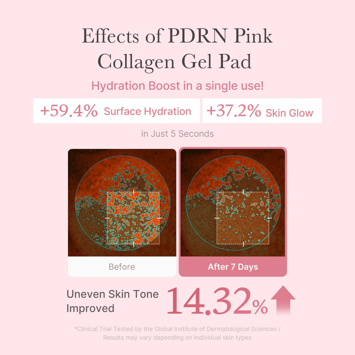 PDRN Pink Collagen Gel Toner Pad — 5