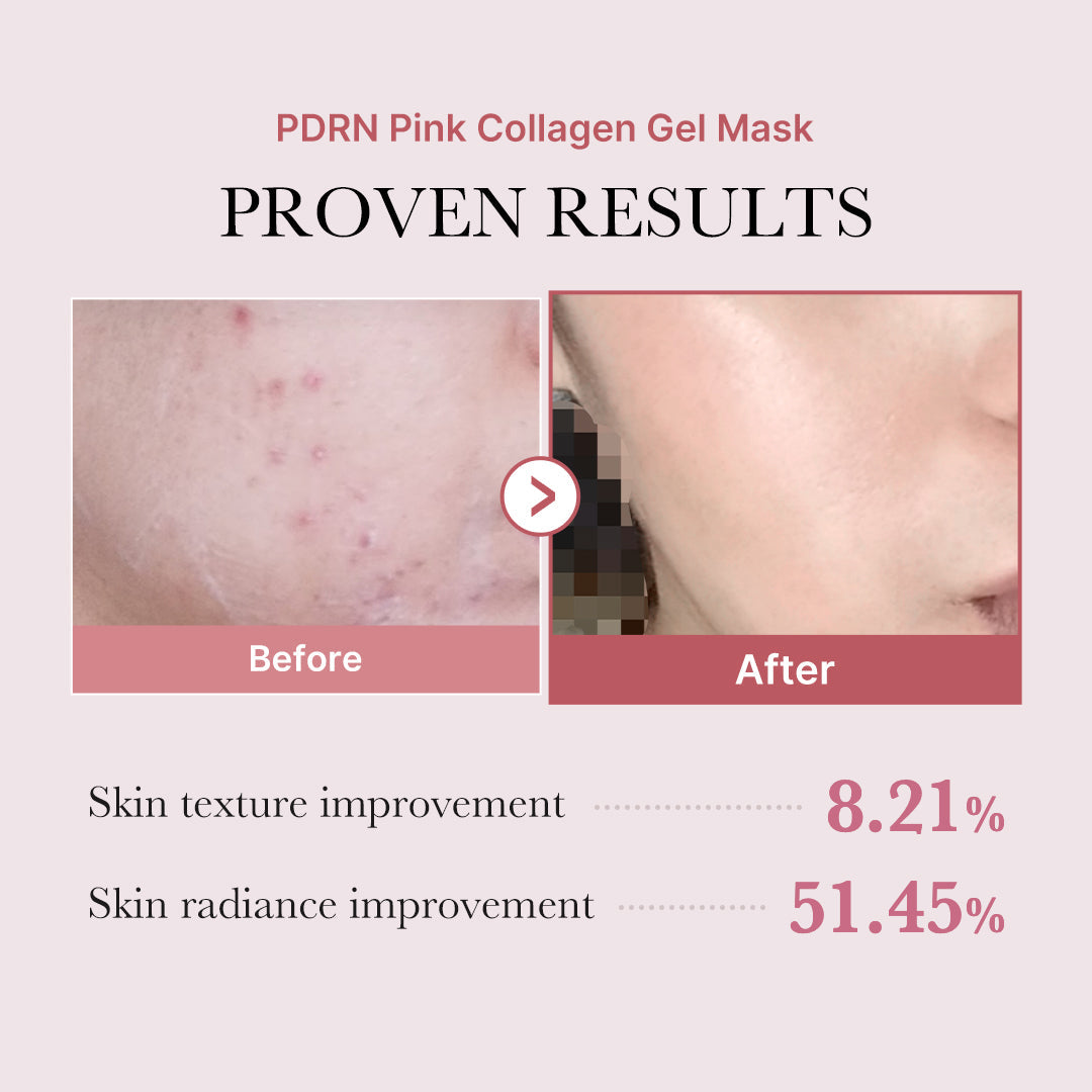 Salmon PDRN Pink Collagen Jelly Gel Mask — 6