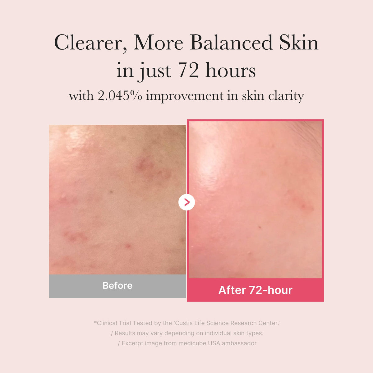 TXA Niacinamide Serum — 3